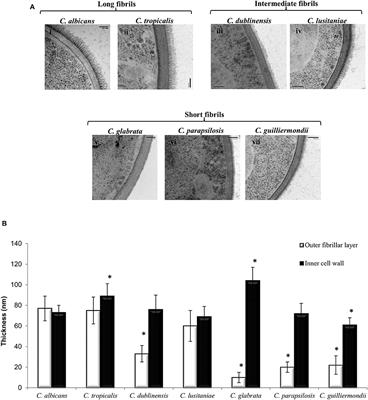 Caspofungin Induced Cell Wall Changes of Candida Species Influences Macrophage Interactions